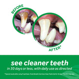 TropiClean Fresh Breath Dental & Oral Care Brushing Gel for Pets